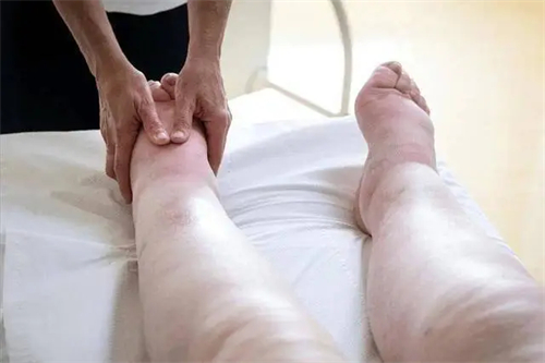 图片细节说明